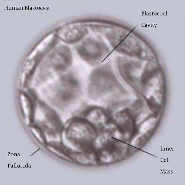 Embryo Grading Explained - the Lucky Egg